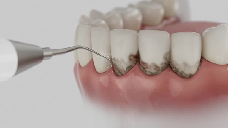 Trusted Teeth Cleaning And Checkup service in Cecil-Bishop, PA - Dentist Open Now